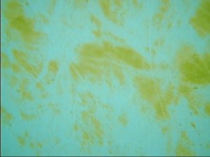 yellow-algae-in-pool