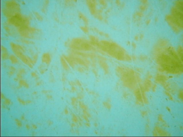 Anti-algues moutardes - Algi Yellow 1L PISCIMAR - Bel'O Piscine